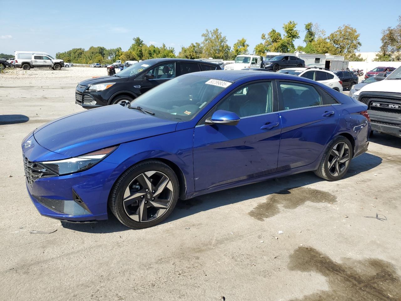 Hyundai ELANTRA Limited Image 1